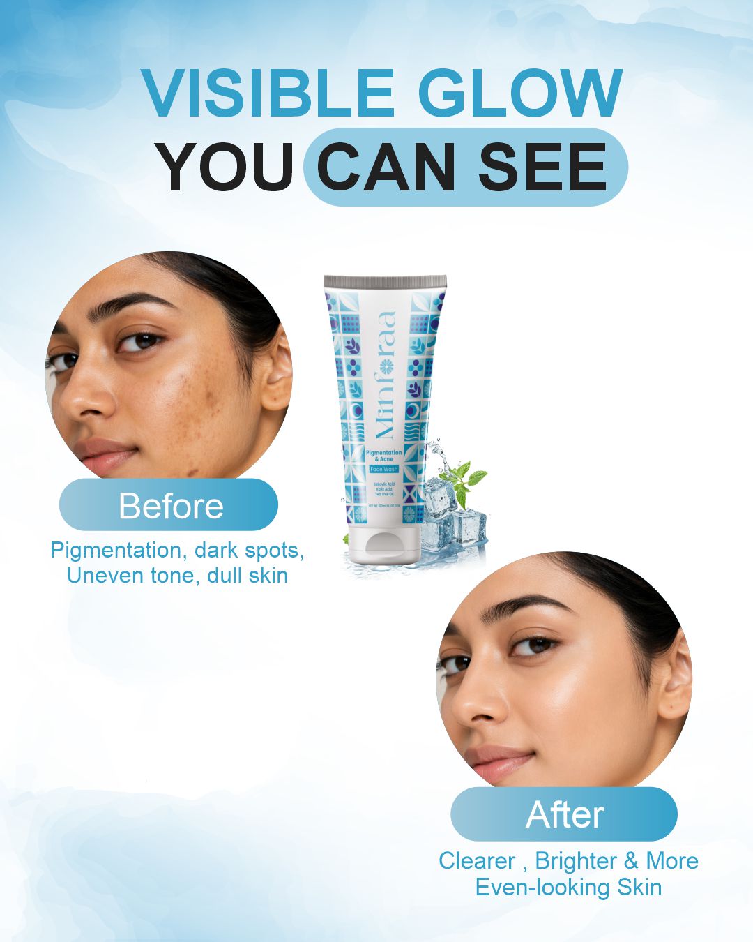 Pigmentation & Acne Face Wash